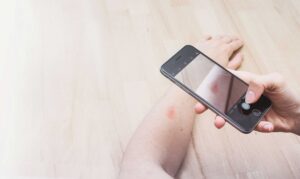 Jetzt Hautproblem online ärztlich abklären lassen