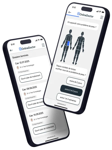 Site web OnlineDoctor pour le diagnostic cutané avec sélection de la zone du corps et durée des symptômes