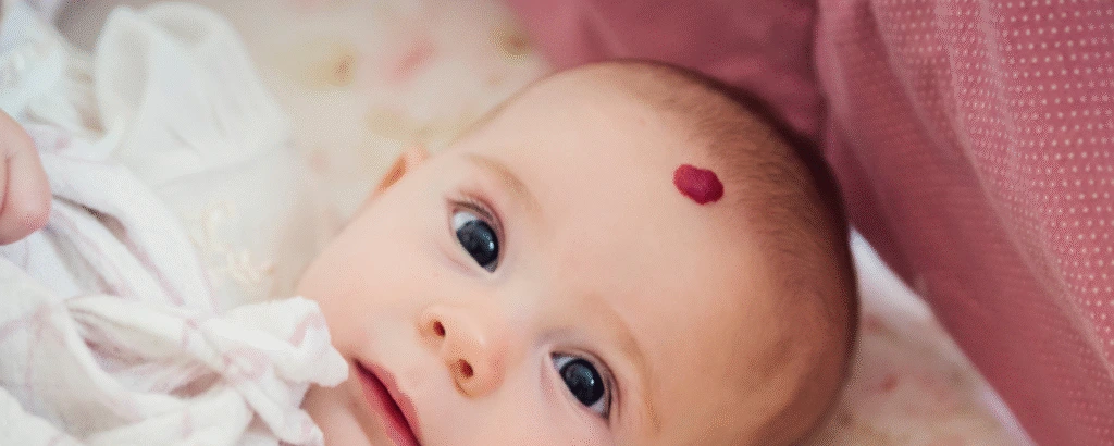 Hämangiom beim Baby